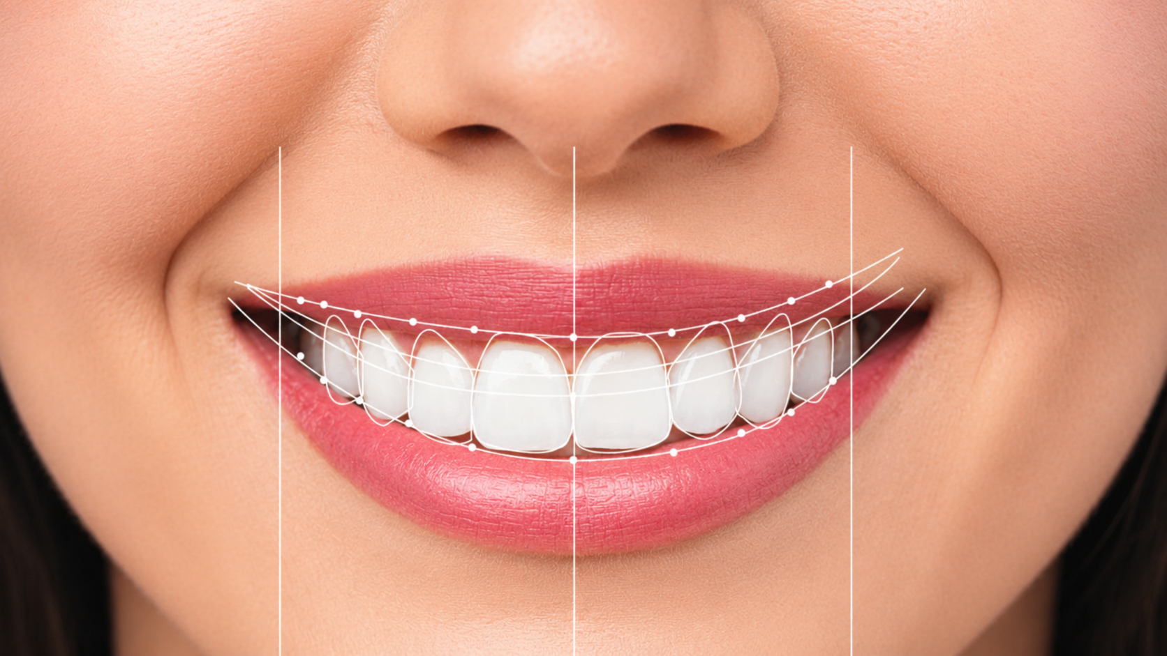 Smile Design in Hanamkonda